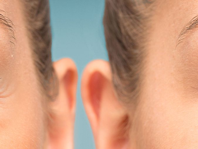 How_to_Get_Rid_of_Eye_Bags_row_1