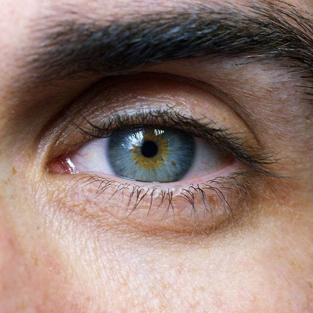 effects_roaccutane_eyes_row_5