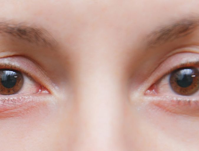 I_have_a_stye_can_I_wear_contact_lenses?_row_1