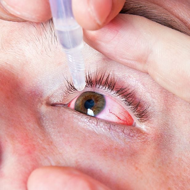 CMS_usar-lentillas_lentillas-y-ojos-rojos_ES_inline_1 (1)