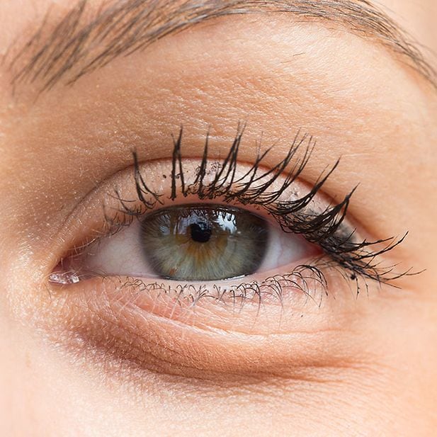 CMS_salud-ocular_parpados-ojos-hinchados_ES_inline_1 (1)