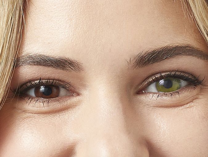 Can_eye_color_change_over_time?_row_1