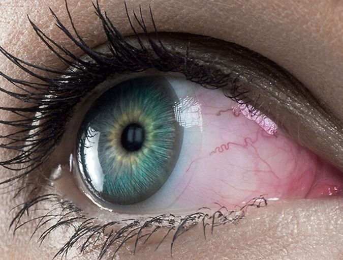 CMS_usar-lentillas_lentillas-y-ojos-rojos_ES_banner