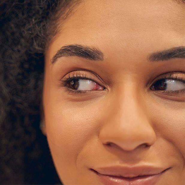Rostro de una chica sonriente que mira hacia un lado.
